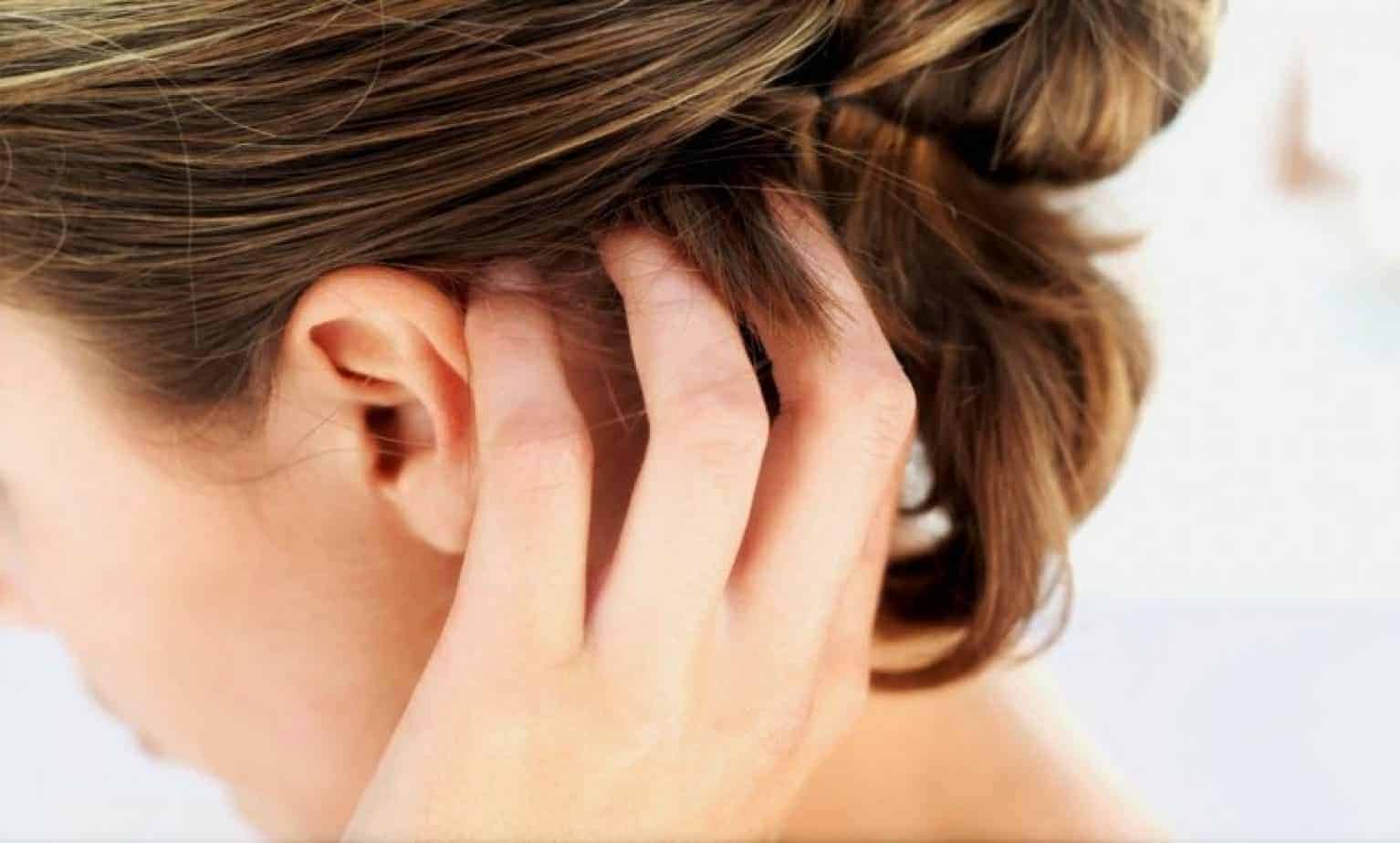 Quelles sont les influences des allergies sur la santé des cheveux ?