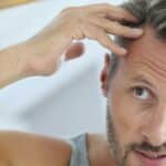 Produit Anti-Chute de Cheveux pour Hommes : Comprendre et Réagir