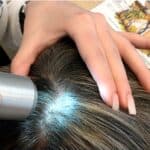Spécialiste du Cuir Chevelu : Diagnostic, Soin et Prévention des Chutes de Cheveux